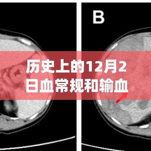 歷史上的12月2日，血常規(guī)與輸血技術(shù)的重大進展與回顧