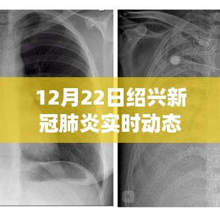 紹興新冠肺炎實時動態報告（12月22日更新），聚焦最新動態分析