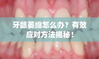 牙齦萎縮怎么辦？有效應對方法揭秘！