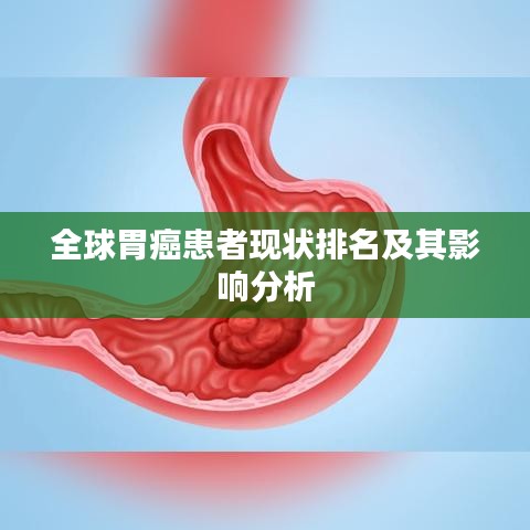 全球胃癌患者現狀排名及其影響分析