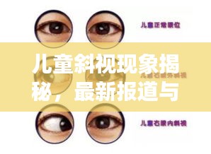 兒童斜視現(xiàn)象揭秘，最新報(bào)道與深度解析