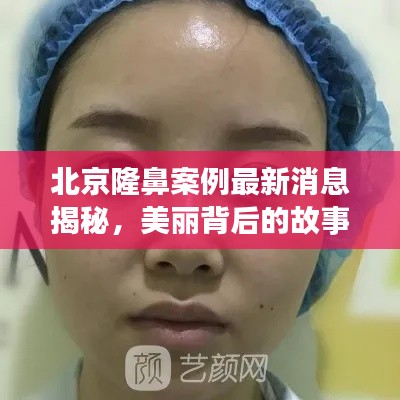 北京隆鼻案例最新消息揭秘，美麗背后的故事！